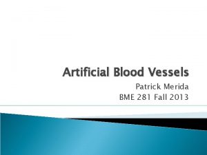 Artificial Blood Vessels Patrick Merida BME 281 Fall