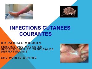INFECTIONS CUTANEES COURANTES DR PASCAL MUSSON SERVICE DES