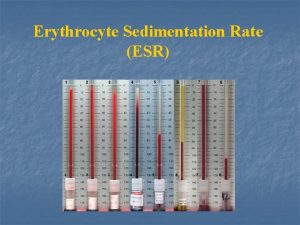 Erythrocyte Sedimentation Rate ESR n n n The