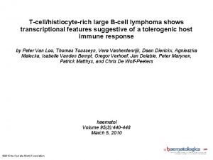 Tcellhistiocyterich large Bcell lymphoma shows transcriptional features suggestive