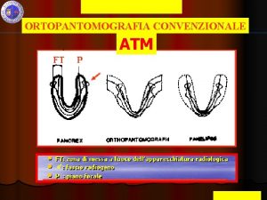 Universita di Catania ORTOPANTOMOGRAFIA CONVENZIONALE ATM M CALTABIANO