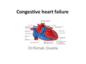 Congestive heart failure DrRehab Gwada Objectives Define Congestive