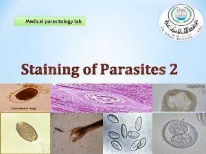 Medical parasitology lab Cryptosporidium parvum Infect human and