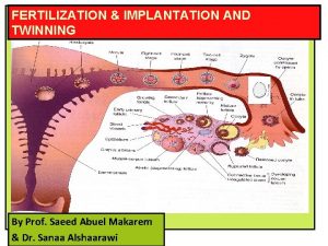 FERTILIZATION IMPLANTATION AND TWINNING By Prof Saeed Abuel