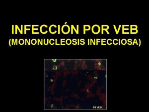 INFECCIN POR VEB MONONUCLEOSIS INFECCIOSA IFI VEB MARCADORES