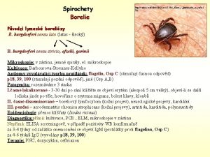 Spirochety Borelie http i idnes cz0506clPOLaee 2573 b