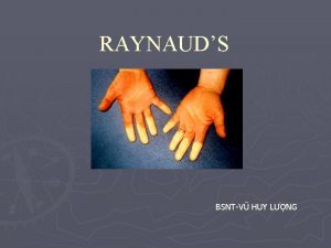 RAYNAUDS BSNTV HUY LNG NH NGHA Raynauds l