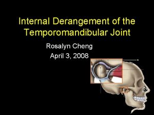 Internal Derangement of the Temporomandibular Joint Rosalyn Cheng