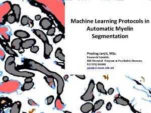 Machine Learning Protocols in Automatic Myelin Segmentation Predrag
