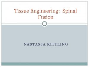 Tissue Engineering Spinal Fusion NASTASJA RITTLING What is