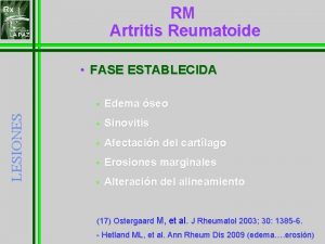 RM Artritis Reumatoide LESIONES FASE ESTABLECIDA Edema seo