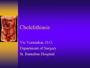 Cholelithiasis Vic Vernenkar D O Department of Surgery