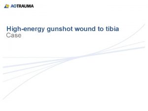Highenergy gunshot wound to tibia Case History 2