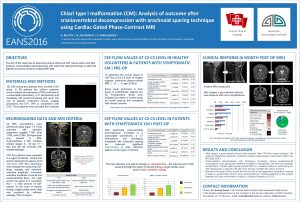 Chiari type I malformation CM Analysis of outcome