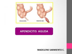 APENDICITIS AGUDA MADELEINE SARMIENTO C ANATOMIA ANATOMIA DEL