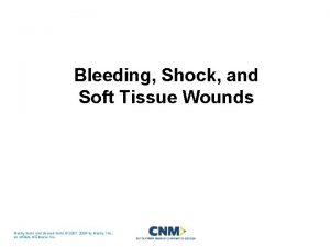 Bleeding Shock and Soft Tissue Wounds Mosby items