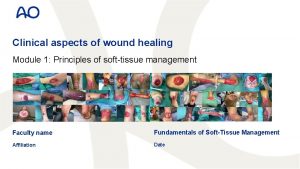 Clinical aspects of wound healing Module 1 Principles