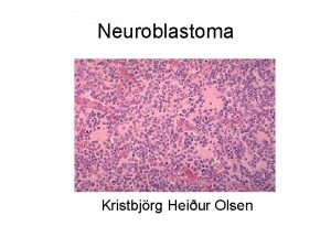 Neuroblastoma Kristbjrg Heiur Olsen Neuroblastoma I Nota um