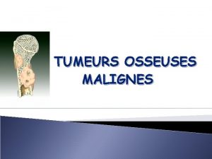 TUMEURS OSSEUSES MALIGNES Introduction Epidmiologique PLAN Frquence Age