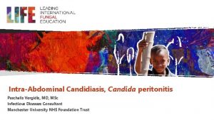 IntraAbdominal Candidiasis Candida peritonitis Paschalis Vergidis MD MSc