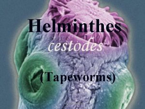 Helminthes Tapeworms Helminthes 2 Phylums Nematodes Roundworms Turbellaria