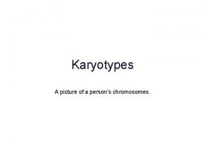 Karyotypes A picture of a persons chromosomes Karyotype