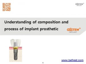 Understanding of composition and process of implant prosthetic