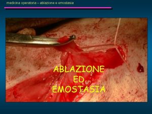 medicina operatoria ablazione e emostasia ABLAZIONE ED EMOSTASIA