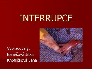 INTERRUPCE Vypracovaly Beneov Jitka Knoflkov Jana Interrupce uml