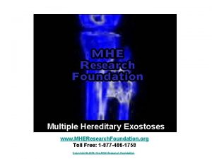 Multiple Hereditary Exostoses www MHEResearch Foundation org Toll