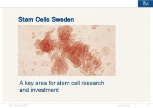 Stem Cells Sweden A key area for stem