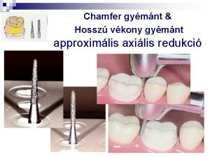 Chamfer gymnt Hossz vkony gymnt approximlis axilis redukci