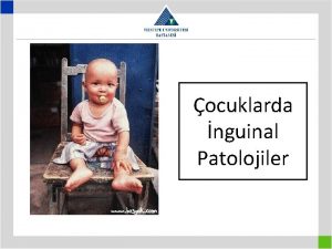 ocuklarda nguinal Patolojiler Testisin g 3 ay 5