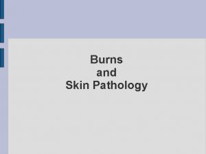 Burns and Skin Pathology Burns 1 st Degree