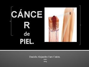 CNCE R de PIEL Daniela Alejandra Caro Can