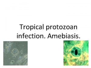 Tropical protozoan infection Amebiasis Protozoa in Greek protofirst