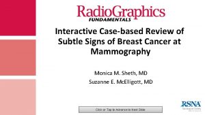 Interactive Casebased Review of Subtle Signs of Breast
