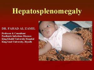Hepatosplenomegaly DR FAHAD AL ZAMIL Professor Consultant Paediatric