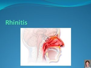 Rhinitis Presentation RHINITIS the presence of one or