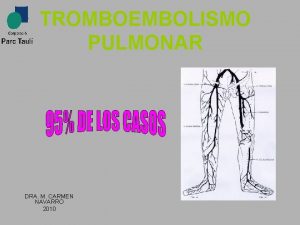 TROMBOEMBOLISMO PULMONAR DRA M CARMEN NAVARRO 2010 Tiene