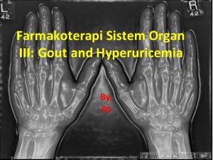 Farmakoterapi Sistem Organ III Gout and Hyperuricemia By