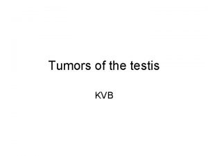 Tumors of the testis KVB Important facts about