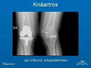 Knartros Jan Viklund ortopedkliniken DIVISION Lnssjukvrd DIVISION Lnssjukvrd
