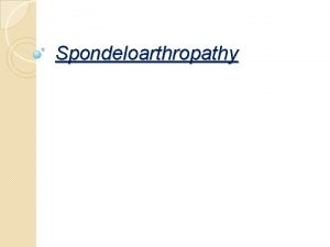 Spondeloarthropathy Psoriatic Arthritis Psoriatic arthritis should be suspected