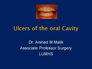 Ulcers of the oral Cavity Dr Arshad M