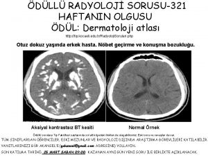 DLL RADYOLOJ SORUSU321 HAFTANIN OLGUSU DL Dermatoloji atlas