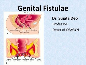 Genital Fistulae Dr Sujata Deo Professor Deptt of