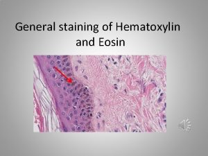 General staining of Hematoxylin and Eosin Haematoxylin in