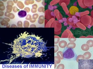 Diseases of IMMUNITY OBJECTIVES Differentiate between the concepts