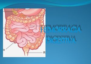 HEMORRAGIA DIGESTIVA Prdida de sangre que se origina